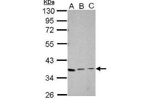WB Image Sample (30 ug of whole cell lysate) A: Jurkat B: K562 C: HL-60 10% SDS PAGE antibody diluted at 1:1000 (XRCC4 antibody  (C-Term))