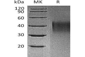 HAVCR1 Protein (His tag)