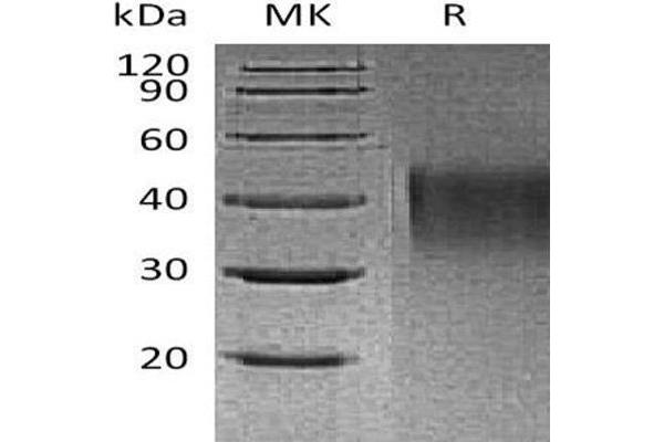 HAVCR1 Protein (His tag)