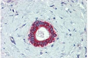 Immunohistochemistry (Formalin-fixed Paraffin-embedded Sections) (IHC (fp)) image for anti-BCL2-Antagonist/killer 1 (BAK1) (AA 1-14) antibody (ABIN573998)