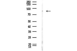 Western blot analysis of lysates from Rat liver, using NEFL Antibody at 1/1000 dilution.