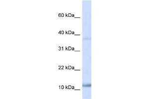 WB Suggested Anti-NHLH1 Antibody Titration:  0. (NHLH1 antibody  (N-Term))