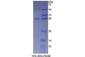 SDS-PAGE (SDS) image for Phosphoglucomutase 1 (PGM1) (AA 1-235) protein (His tag) (ABIN4989493)