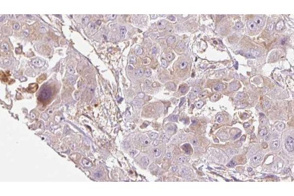 OR1E1 antibody  (C-Term)