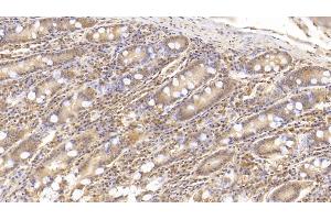 Detection of IL6 in Human Small intestine Tissue using Monoclonal Antibody to Interleukin 6 (IL6) (IL-6 antibody  (AA 30-212))
