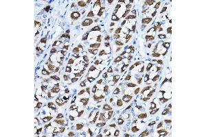 Immunohistochemistry of paraffin-embedded rat stomach using PGLS Rabbit pAb (ABIN6131432, ABIN6145509, ABIN6145510 and ABIN6224398) at dilution of 1:200 (40x lens).