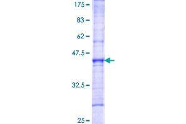 ATP11C Protein (AA 441-545) (GST tag)