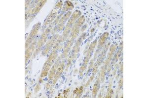 Immunohistochemistry of paraffin-embedded mouse stomach using RARS2 antibody at dilution of 1:100 (x40 lens). (RARS2 antibody)
