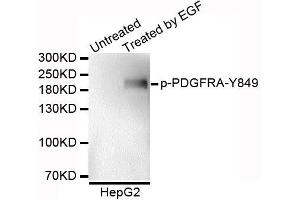 Western blot analysis of extracts of HepG2 cells, using Phospho-PDGFRA-Y849 antibody. (PDGFRA antibody  (pTyr849))