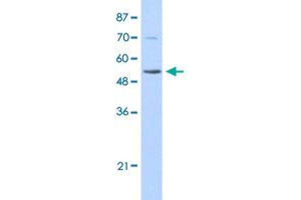 IKZF3 antibody  (N-Term)