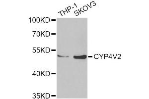 Western blot analysis of extracts of various cell lines, using CYP4V2 Antibody (ABIN2562110) at 1:1000 dilution.