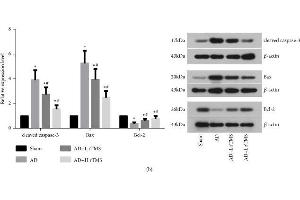 Effect of rTMS on apoptosis and viability of neurons in hippocampus regions of AD mice. (beta Actin antibody  (AA 1-25))