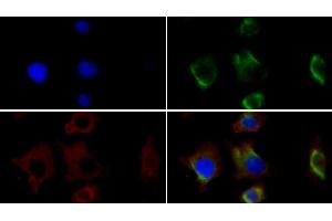Detection of VIM in Human HepG2 cell using Monoclonal Antibody to Vimentin (VIM) (Vimentin antibody)