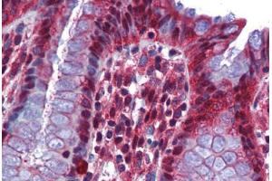 Human Colon: Formalin-Fixed, Paraffin-Embedded (FFPE) (RBM47 antibody  (AA 287-336))