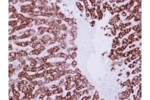 Image no. 1 for anti-Aldehyde Dehydrogenase 6 Family, Member A1 (ALDH6A1) (AA 1-255) antibody (ABIN1496604) (ALDH6A1 antibody  (AA 1-255))