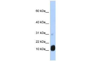 GCHFR antibody used at 1 ug/ml to detect target protein. (GCHFR antibody  (N-Term))