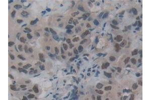 Immunohistochemistry (IHC) image for anti-DNA Fragmentation Factor, 45kDa, alpha Polypeptide (DFFA) (AA 51-305) antibody (ABIN7442849)