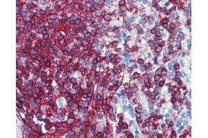 Anti-CD44 antibody IHC of human spleen. (CD44 antibody  (FITC))