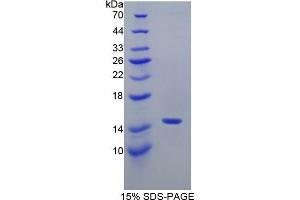 SDS-PAGE (SDS) image for Neurofilament, Light Polypeptide (NEFL) (AA 281-396) protein (His tag) (ABIN1170999) (NEFL Protein (AA 281-396) (His tag))