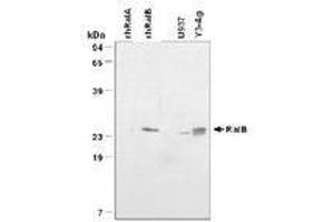 Image no. 1 for anti-V-Ral Simian Leukemia Viral Oncogene Homolog B (Ras Related, GTP Binding Protein) (Ralb) antibody (ABIN204644) (RALB antibody)