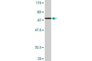 Western Blot detection against Immunogen (70. (Gasdermin B antibody  (AA 1-411))
