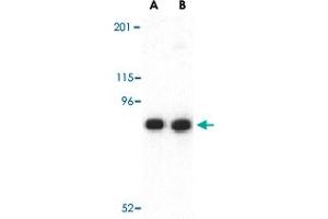 Western blot analysis of CDH13 in NIH/3T3 lysate with CDH13 polyclonal antibody  at (A) 0. (Cadherin 13 antibody  (N-Term))