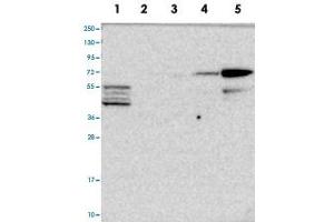 Western blot analysis of Lane 1: RT-4, Lane 2: U-251 MG, Lane 3: Human Plasma, Lane 4: Liver, Lane 5: Tonsil with CLIP4 polyclonal antibody  at 1:100-1:250 dilution. (CLIP4 antibody)
