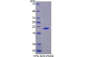 SDS-PAGE analysis of Rat PYGL Protein.