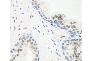 Immunohistochemistry of paraffin-embedded Human prostate using PPAN Polyclonal Antibody at dilution of 1:200 (40x lens). (PPAN antibody)