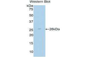 Western Blotting (WB) image for anti-Thyroid Peroxidase (TPO) (AA 19-846) antibody (ABIN1860847) (Thyroperoxidase antibody  (AA 19-846))