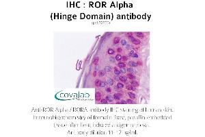 Image no. 2 for anti-RAR-Related Orphan Receptor A (RORA) antibody (ABIN1738922) (RORA antibody)