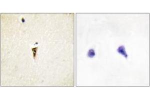 Immunohistochemistry (IHC) image for anti-Intestinal Cell (MAK-Like) Kinase (ICK) (AA 241-290) antibody (ABIN2889811) (ICK antibody  (AA 241-290))