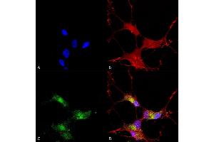 Immunocytochemistry/Immunofluorescence analysis using Mouse Anti-SHANK3 Monoclonal Antibody, Clone S69-46 (ABIN2485417). (SHANK3 antibody  (AA 840-857) (PE))