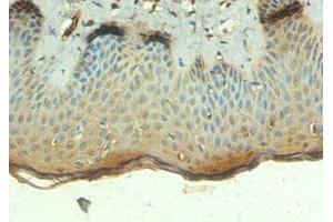 Immunohistochemistry of paraffin-embedded human skin tissue using  at dilution of 1:100