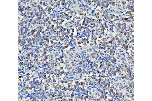 IHC analysis of Asparagine synthetase/ASNS using anti-Asparagine synthetase/ASNS antibody (ABIN7599465). (Asparagine Synthetase antibody  (AA 1-531))