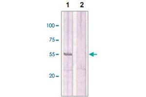 The whole cell lysates derived from MCF-7 were immunoblotted by ESR2 polyclonal antibody  at 1 : 500 (Lane 1). (ESR2 antibody  (C-Term))
