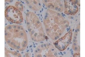 Detection of VSNL1 in Human Kidney Tissue using Polyclonal Antibody to Visinin Like Protein 1 (VSNL1) (VSNL1 antibody  (AA 39-184))