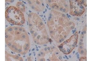 Detection of VSNL1 in Human Kidney Tissue using Polyclonal Antibody to Visinin Like Protein 1 (VSNL1) (VSNL1 antibody  (AA 39-184))
