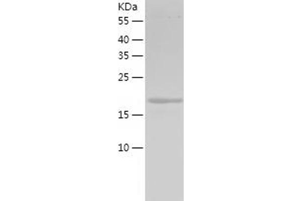 FGF18 Protein (AA 28-207) (His tag)