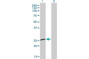 Western Blot analysis of IFNA8 expression in transfected 293T cell line by IFNA8 MaxPab polyclonal antibody. (IFNA8 antibody  (AA 1-189))