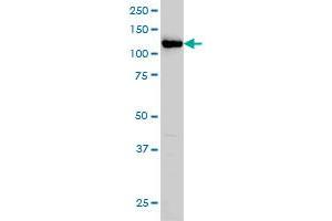 HIP1 monoclonal antibody (M01), clone 1F12 Western Blot analysis of HIP1 expression in HeLa . (HIP1 antibody  (AA 928-1037))