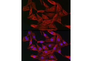Immunofluorescence analysis of NIH-3T3 cells using Gelsolin Rabbit pAb (ABIN7267365) at dilution of 1:50 (40x lens). (Gelsolin antibody  (AA 543-782))