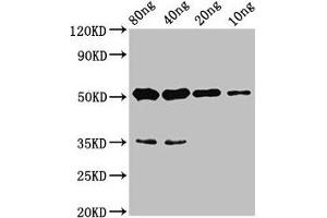 Western Blot Positive WB detected in Recombinant protein All lanes: cyp26b1 antibody at 4. (CYP26B1 antibody  (AA 366-511))