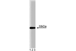 Western blot analysis of EB1 on a human endothelial cell lysate.