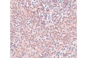 Immunohistochemistry (IHC) image for anti-Nanog Homeobox (NANOG) (Middle Region) antibody (ABIN1031009) (Nanog antibody  (Middle Region))