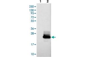 Western blot analysis of Lane 1: Negative control (vector only transfected HEK293T lysate), Lane 2: Over-expression Lysate (Co-expressed with a C-terminal myc-DDK tag (~3. (PRAP1 antibody)