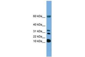 Image no. 1 for anti-Leukotriene C4 Synthase (LTC4S) (N-Term) antibody (ABIN6746296) (LTC4S antibody  (N-Term))