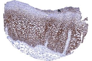 Esophagus squamous epithelium In the esophagus a strong membranous Dsg3 immunostaining predominantly occurs in the lower 2_3 of the squamous epithelium (Desmoglein 3 antibody  (AA 379-491))