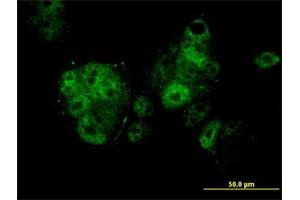 Immunofluorescence of monoclonal antibody to MEF2A on MCF-7 cell. (MEF2A antibody  (AA 71-170))