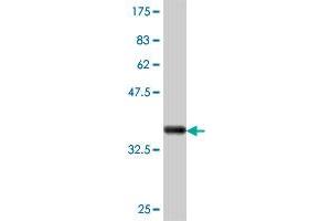 Western Blot detection against Immunogen (38. (CD11c antibody  (AA 114-223))